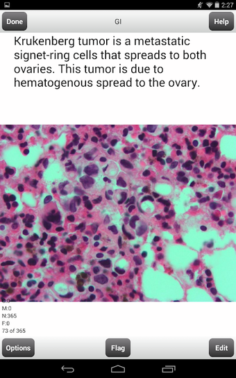 Image 0 pour USMLE Step 2 CK Cards Lit…
