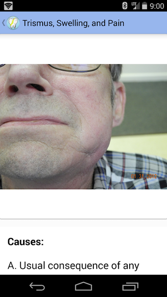 Obraz 0 dla Oral Surgery Complication…