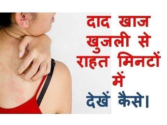 Obraz 0 dla खुजली के इलाज Khujli Ke I…