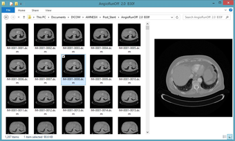 Image 0 pour DICOm Thumbnailer