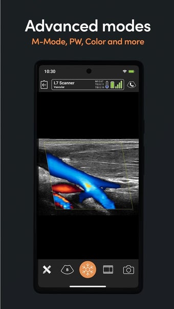 Obraz 0 dla Clarius Ultrasound