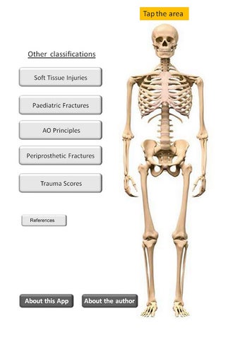 Trauma Classifications at Hand