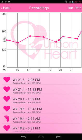 Fetal Doppler UnbornHeart