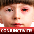 程序图标: Conjunctivitis & Pinkeye …